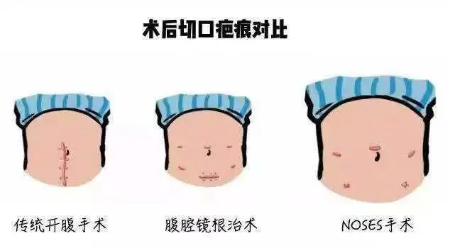 5a42a4e209aa110e569d123575f578d5.png